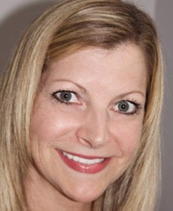 Photo of patient after smile makeover