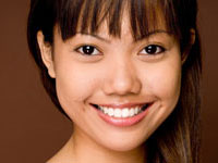 sample photo of a woman with Porcelain dental veneers