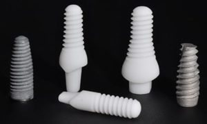 titanium and metal-free dental implants